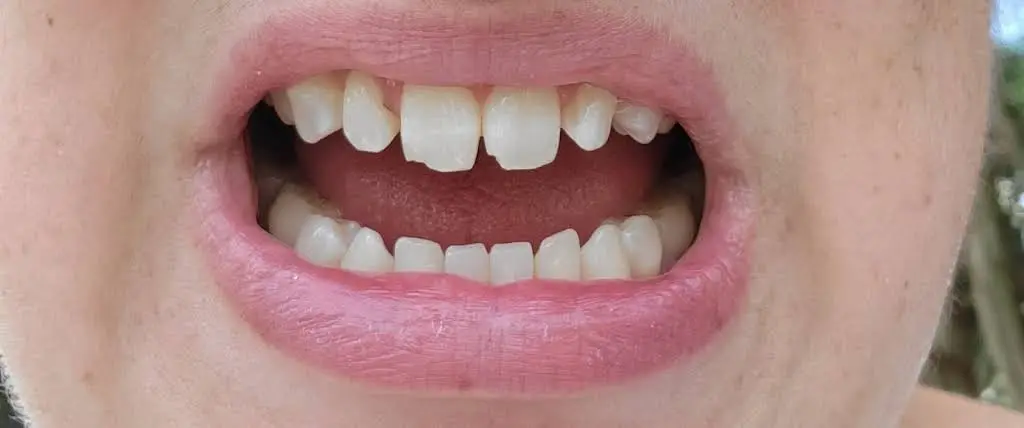 Wake Dental - Cary