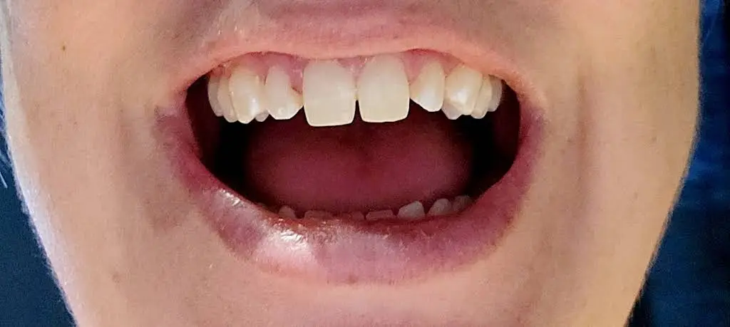 Wake Dental - Cary