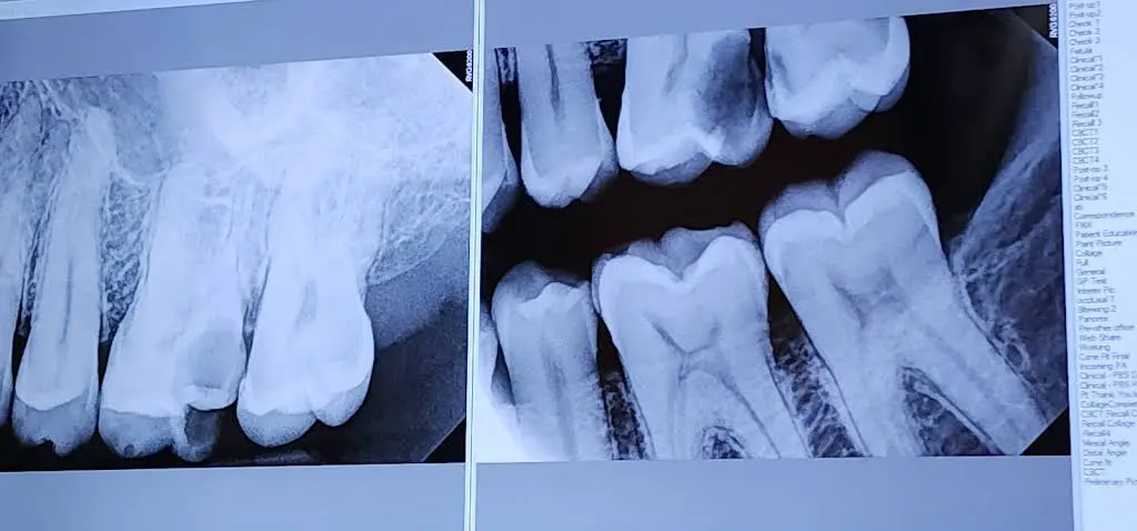 757 Endodontics: Ligon & Royzenblat