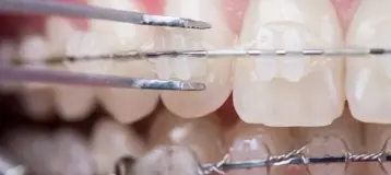 Oyster Point Dental