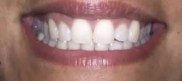 Smiles By Shaw