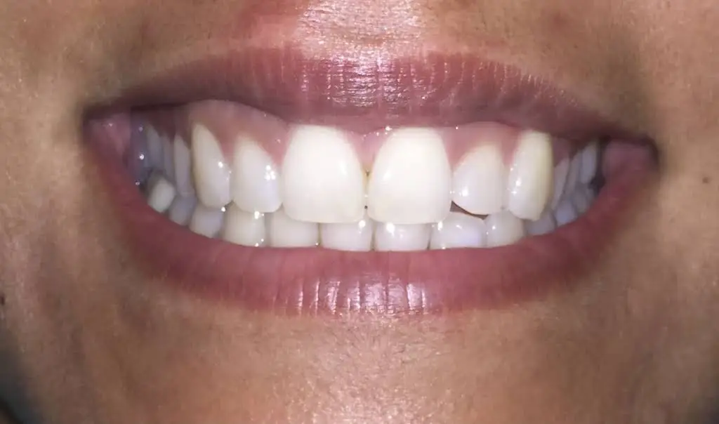Smiles By Shaw