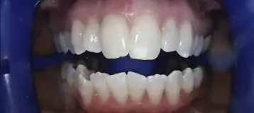 Moore Family Dentistry: Adam Moore, DDS