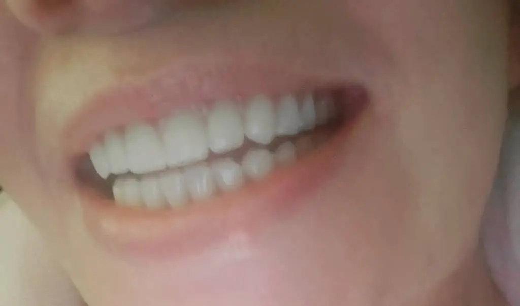 A PLUS DENTURES