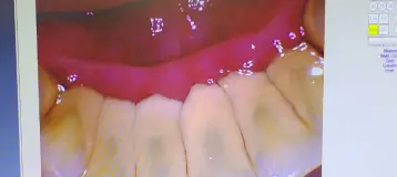East Chocolate Dental