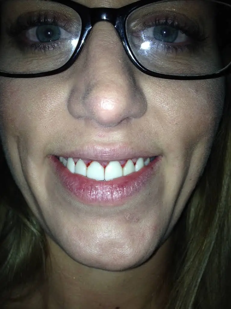 East Chocolate Dental