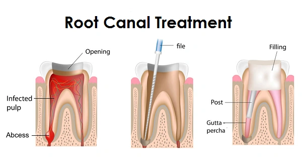 Zorn Dental Associates