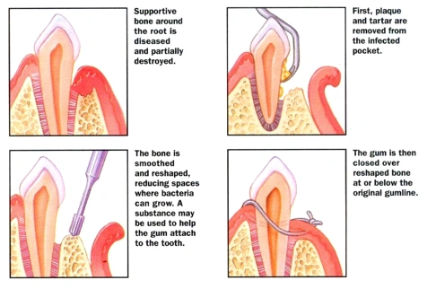 Cary Periodontics and Implant Dentistry