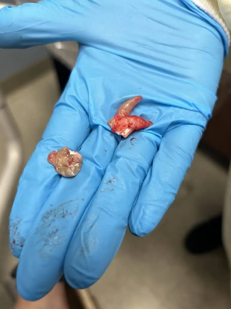 Affordable Dentures & Implants