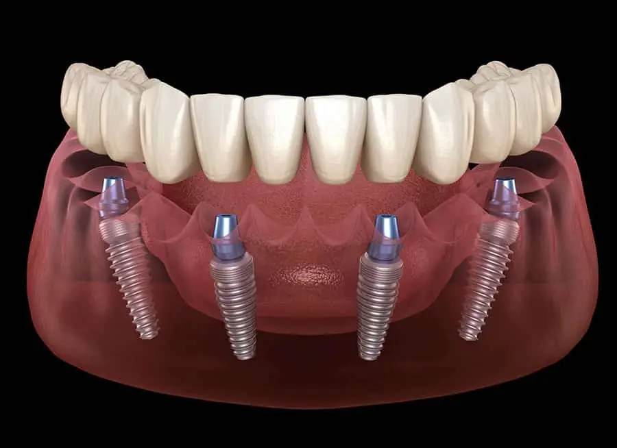 Breeze Dental