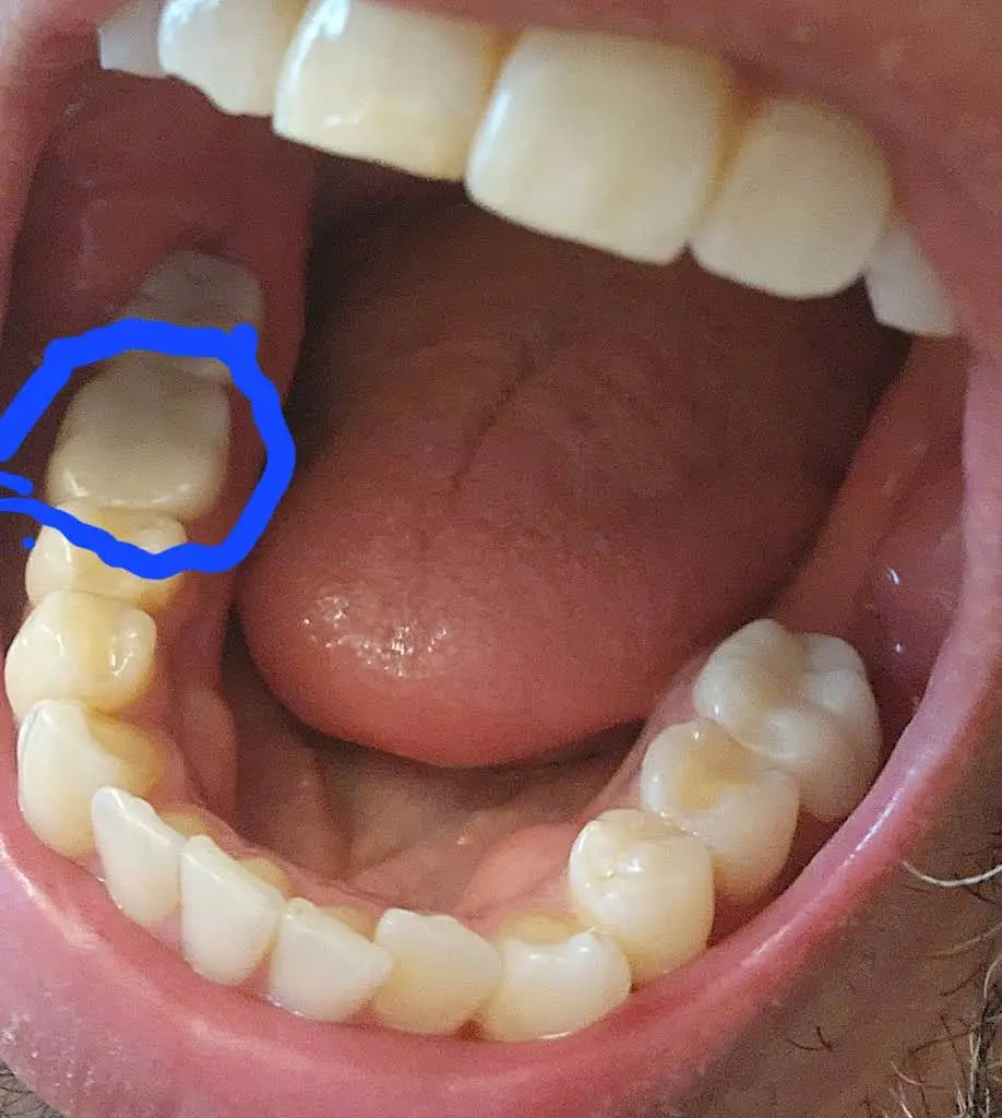 Aspen Dental - Greenville, NC
