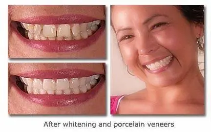 Cary Implant and General Dentistry