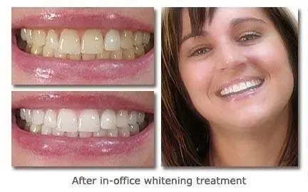 Cary Implant and General Dentistry