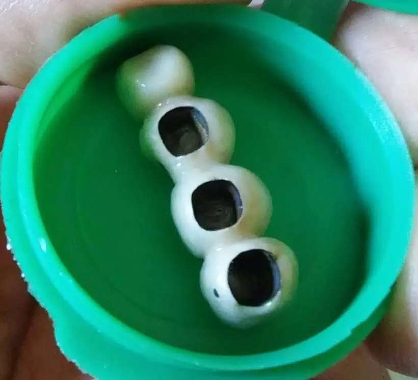 Peninsula Total Dental Care Center