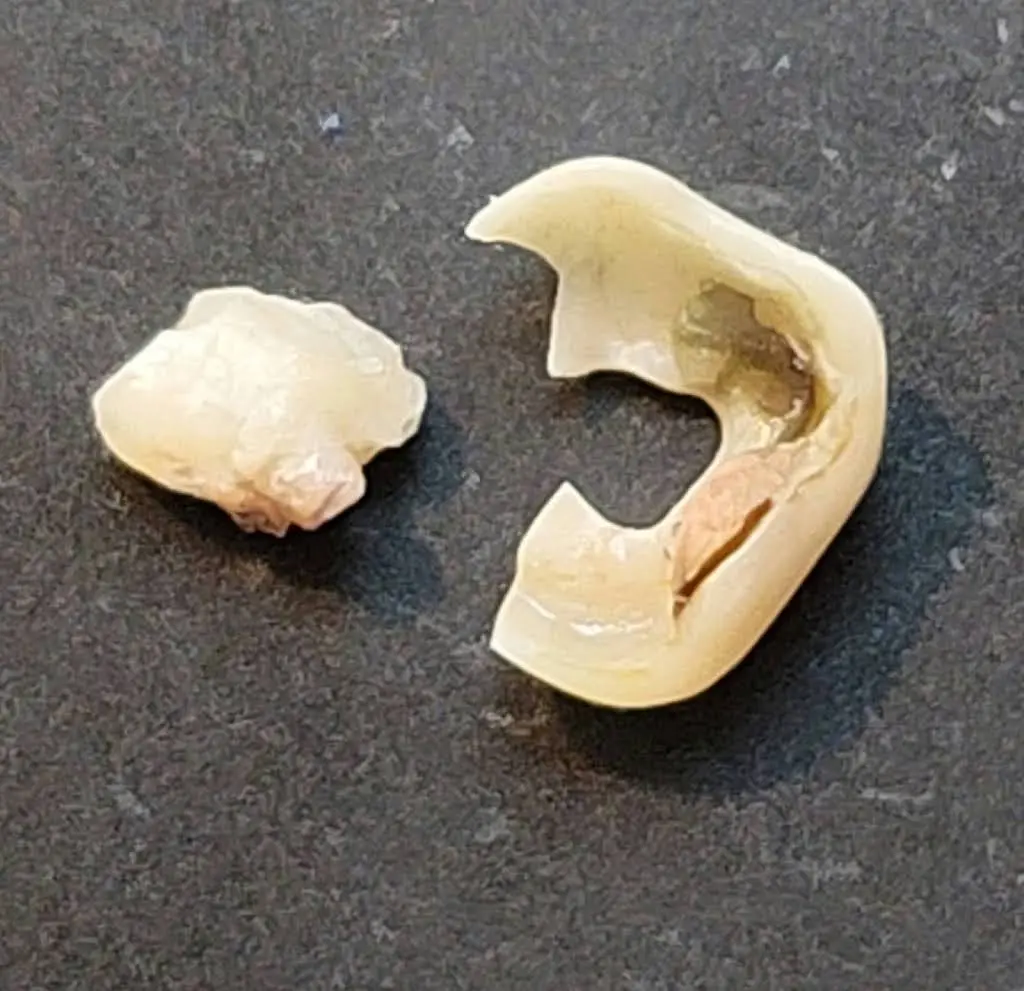Sweet Tooth Dental