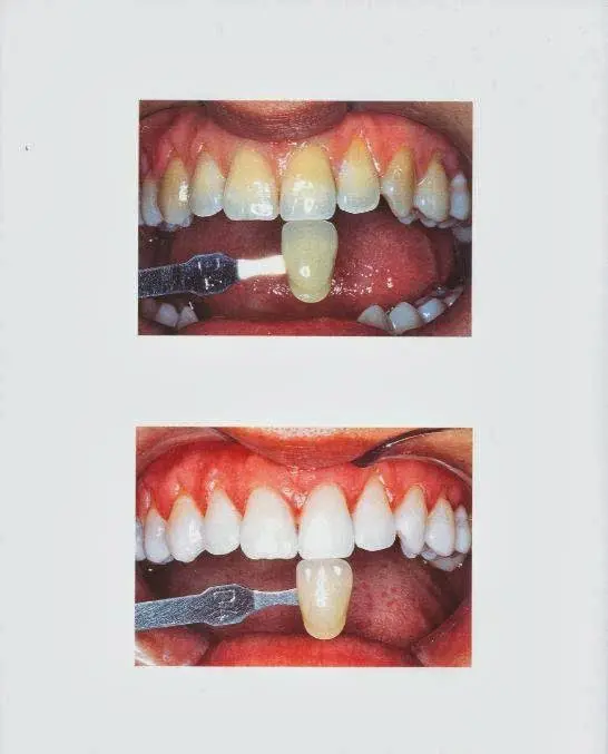 Partners In Dental Health Great Neck