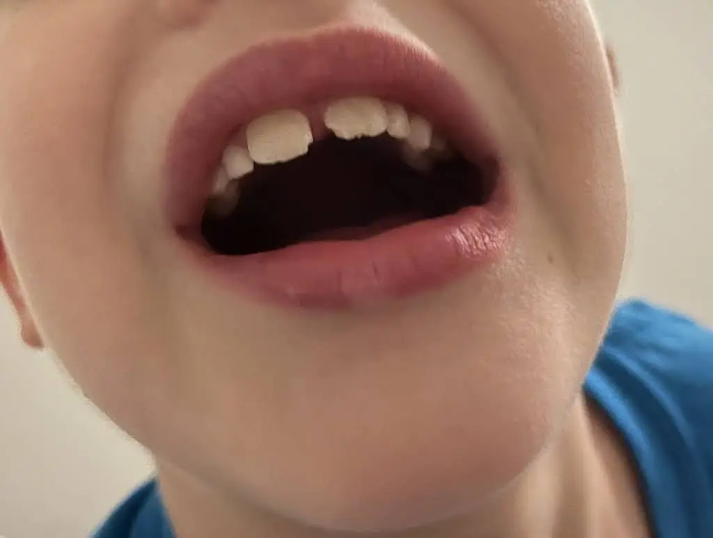 Atlantic Dental Cosmetic & Family Dentistry