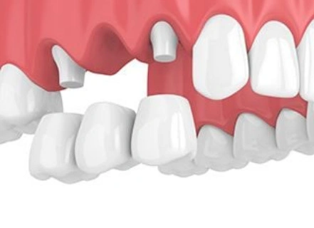 Dentistry In the Pines