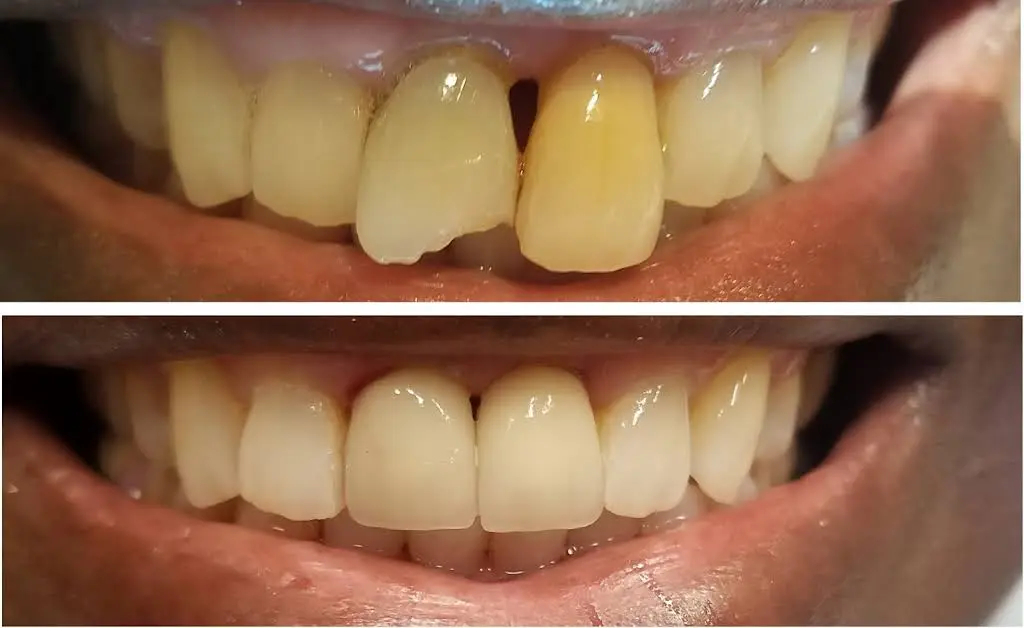 Apple Dental