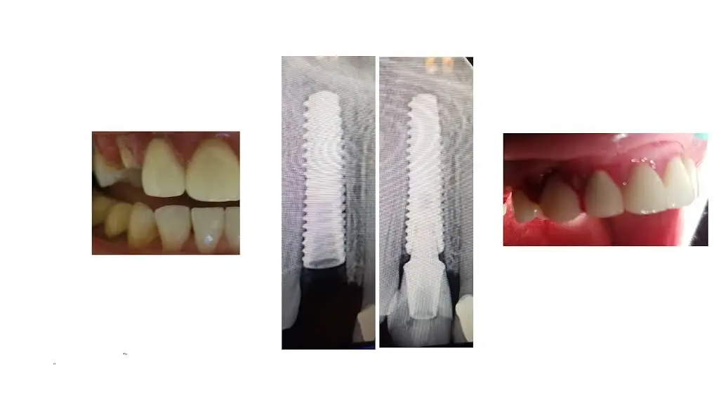 Apple Dental