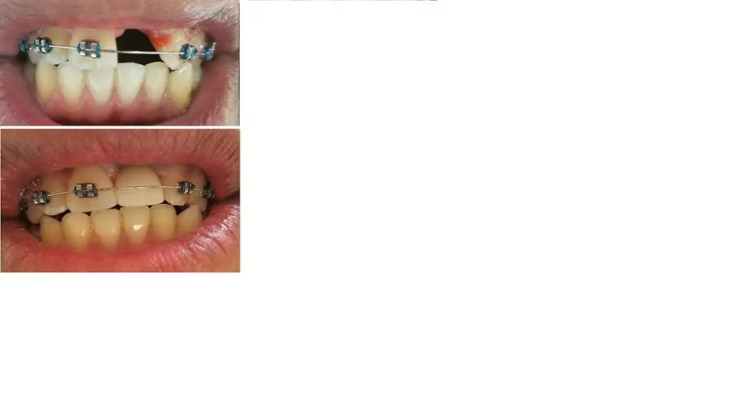 Apple Dental