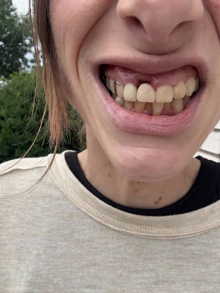 Aspen Dental