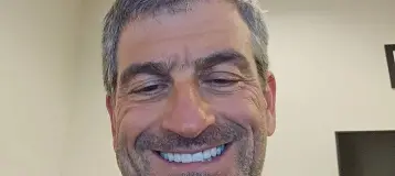 Apex Smiles
