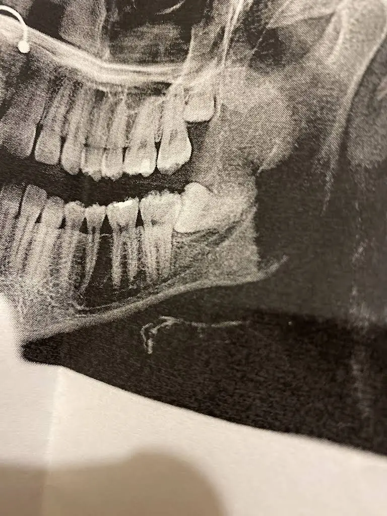 Spencer Dental & Braces