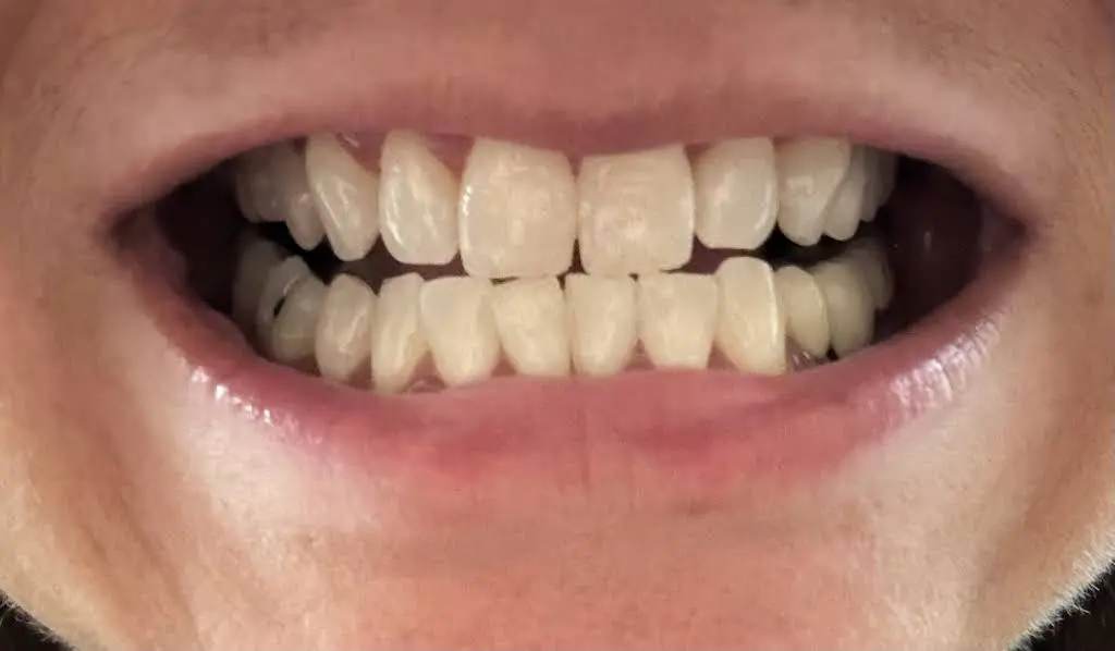 Konikoff Family Dentistry - Brambleton