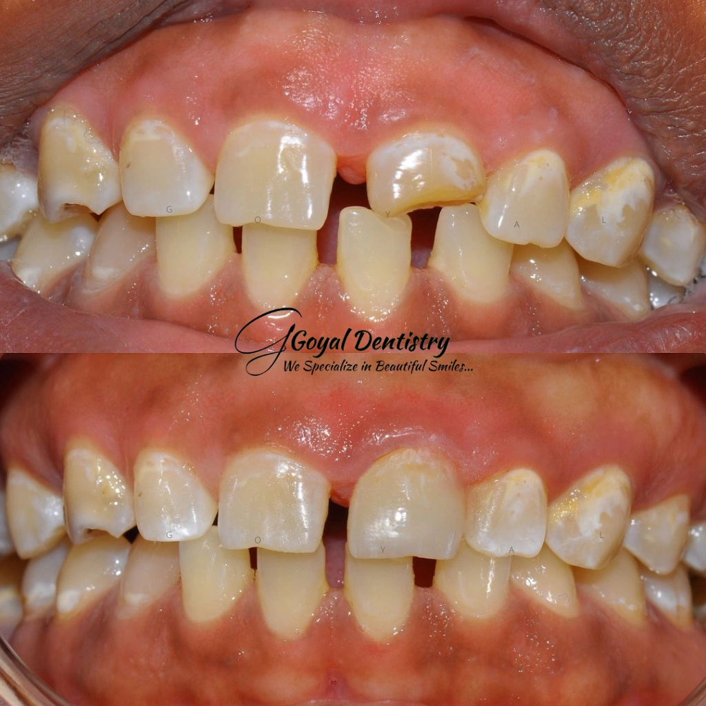 Goyal Dentistry