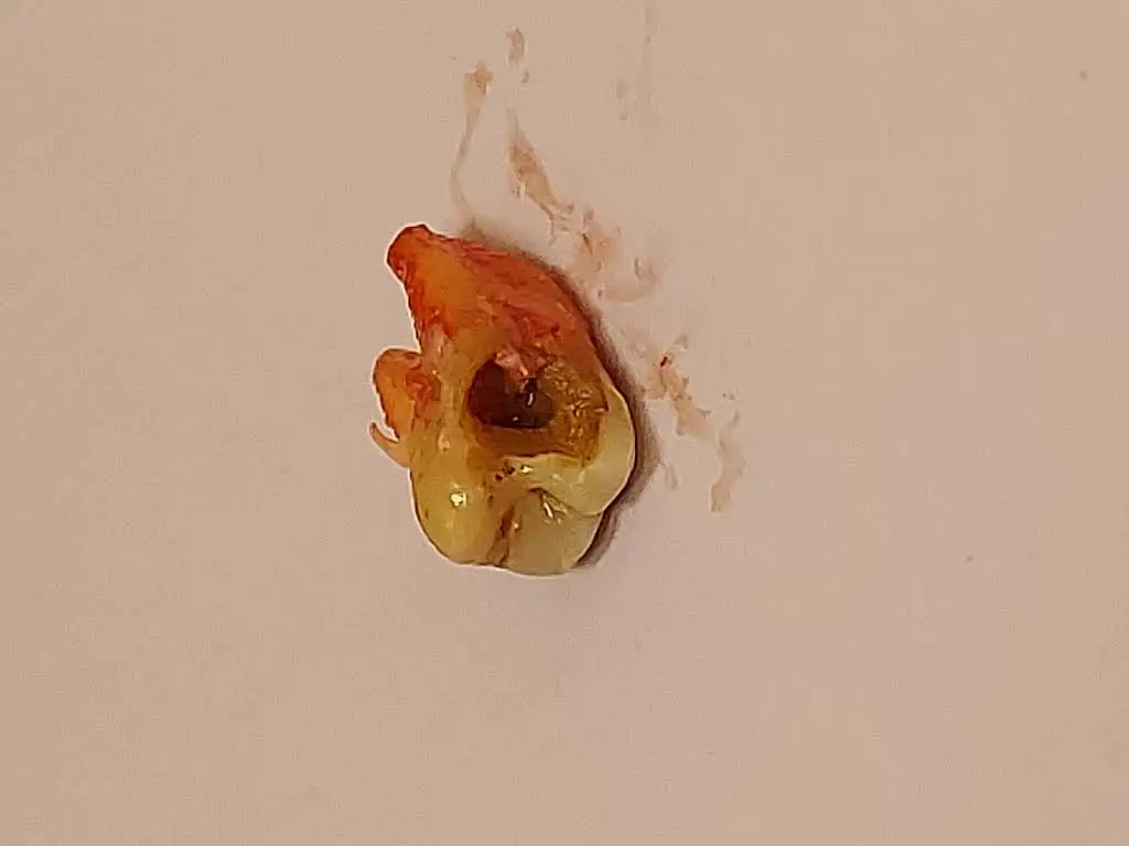 Aspen Dental