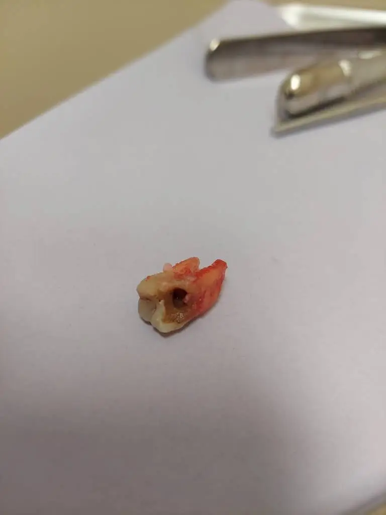 Aspen Dental