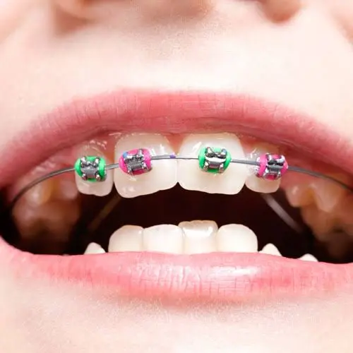 Viechnicki Orthodontics Kutztown