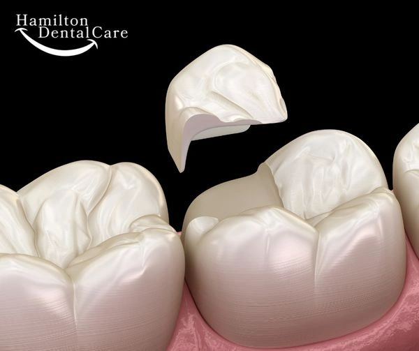 Hamilton Dental Care