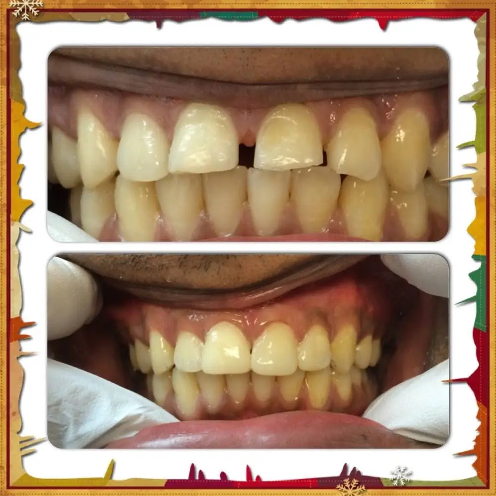 Bright Smile Dental Art