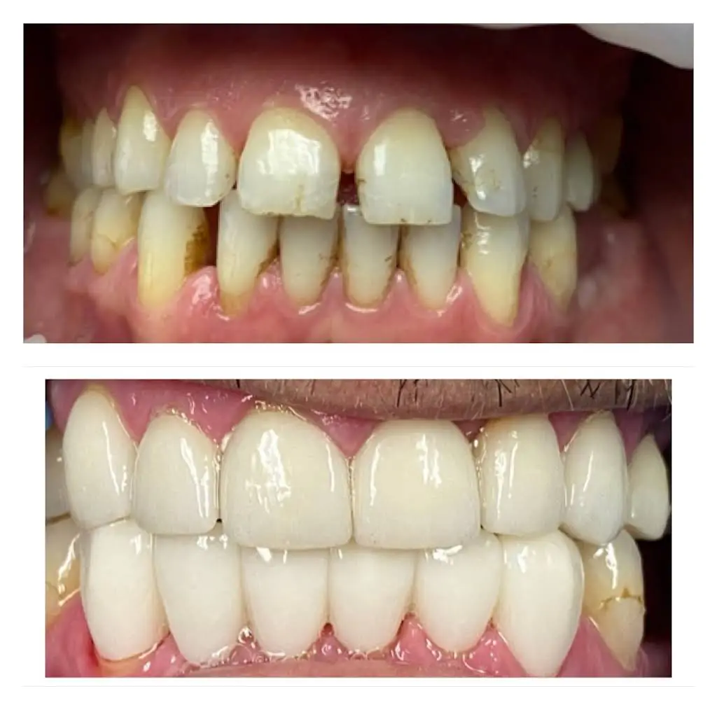 Bright Smile Dental Art