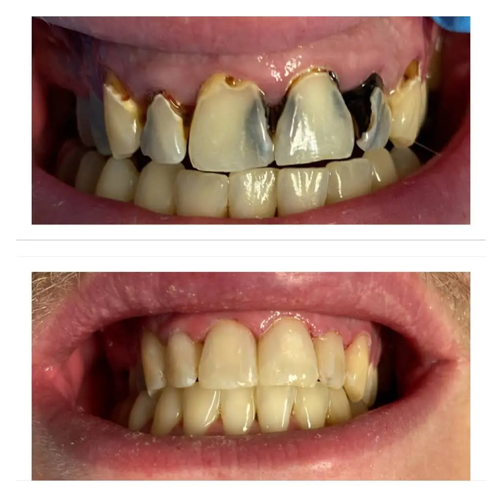 Bright Smile Dental Art