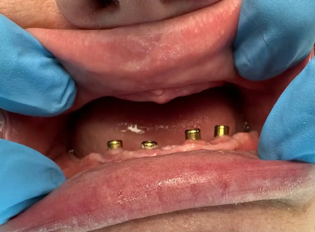 Bright Smile Dental Art