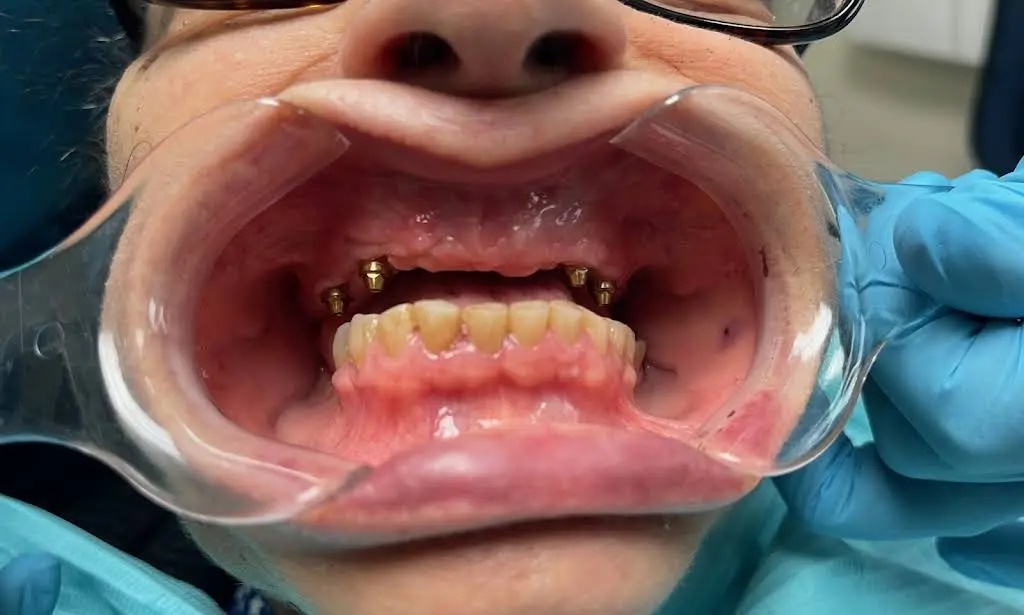 Bright Smile Dental Art