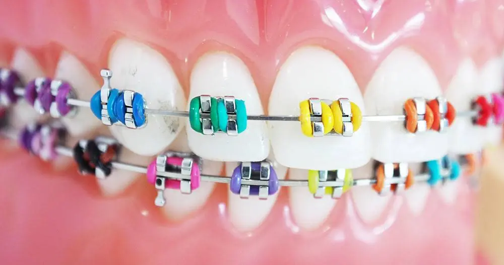 Shine Orthodontics