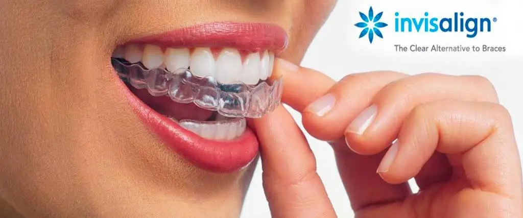 Shine Orthodontics