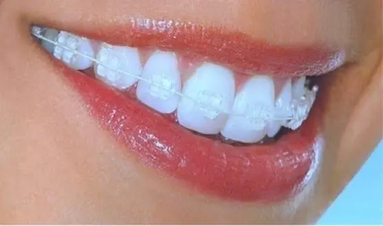 Shine Orthodontics