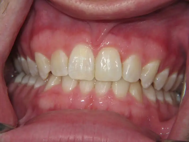 Huntingtown Dental