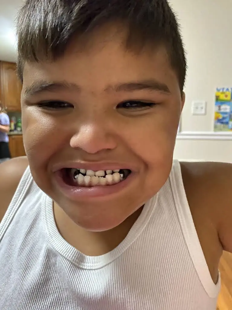 Fredericksburg Pediatric Dentistry and Orthodontics - Kakar Dental Group