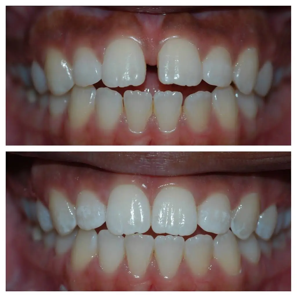 Bright Smiles Cosmetic & Implant Dentistry