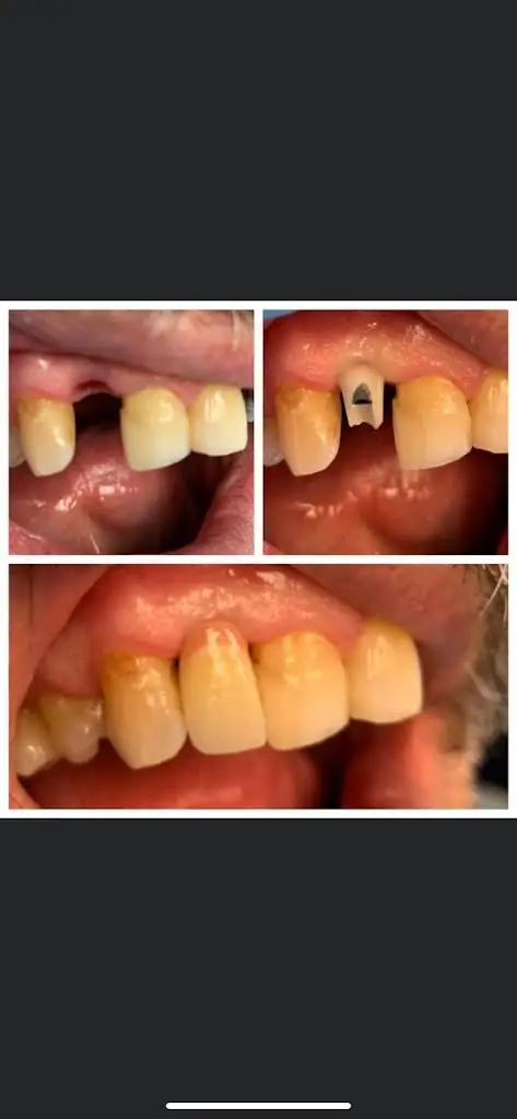 Bright Smiles Cosmetic & Implant Dentistry