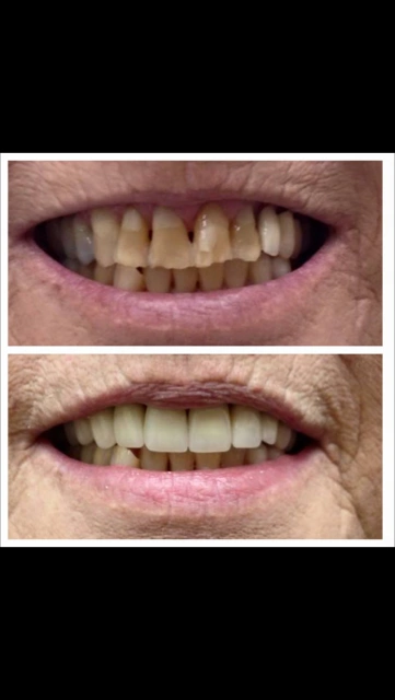Bright Smiles Cosmetic & Implant Dentistry