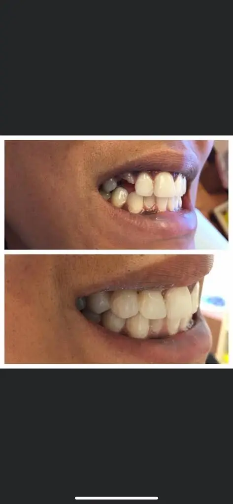 Bright Smiles Cosmetic & Implant Dentistry