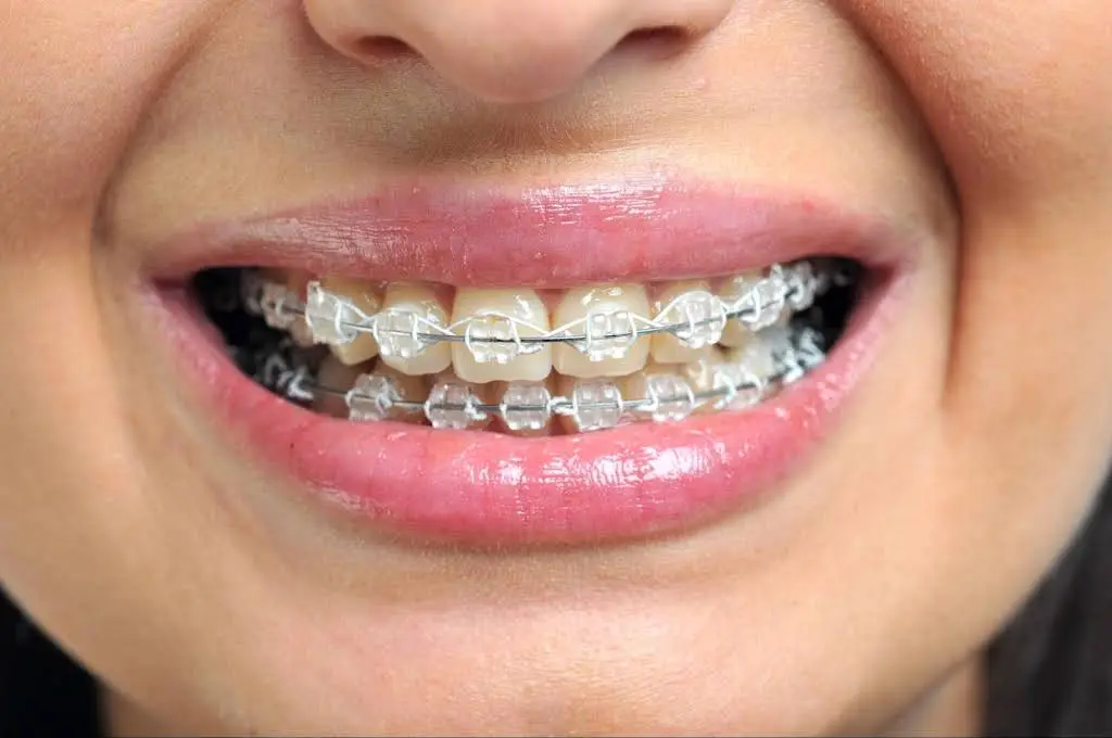 Meader Family Dentistry