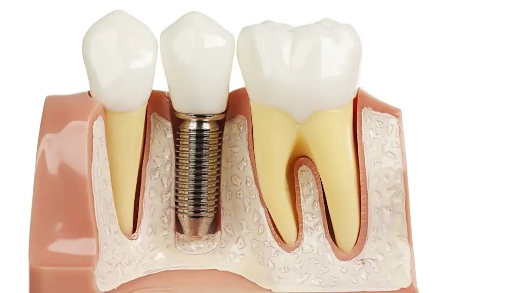 Locust Family Dentistry